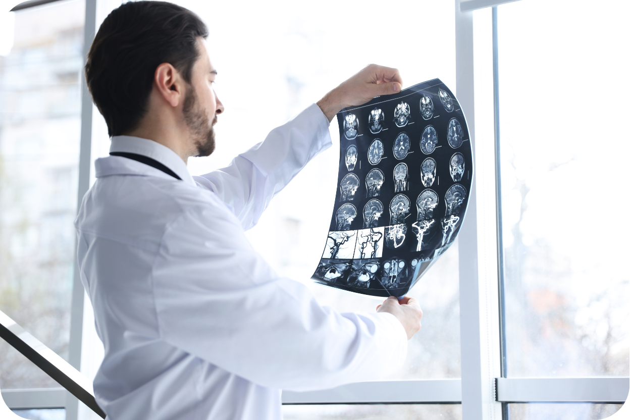 A imagem mostra um médico, de jaleco branco, em um ambiente bem iluminado (provavelmente um consultório ou clínica, com uma grande janela ao fundo), olhando atentamente para uma folha de exame de imagem. A folha, que parece ser uma chapa de ressonância magnética ou tomografia, exibe múltiplas "fatias" ou cortes axiais do cérebro. O médico está de costas ou de perfil, segurando o filme contra a luz para melhor visualização.